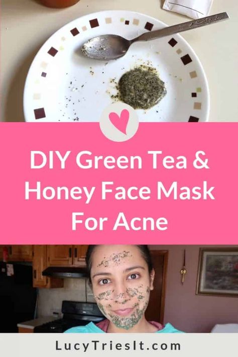 Are you experiencing acne inflammation? Then you might want to try this DIY green tea and honey face mask recipe. Once you experience the skincare benefits of this mask, you’ll be sure to make it a regular in your beauty routine. Click to learn how to make this awesome natural face mask for acne! #DIYskincare #acne Green Tea And Honey, Honey Face Mask, Acne Face Mask, Honey Face, Natural Face Mask, Tumeric Face Mask, Green Tea Mask, Face Mask Recipe, Face Scrub Homemade