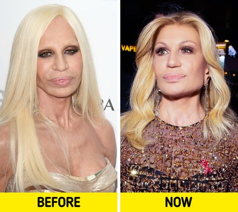 Donatella Versace Young, Face Makeover, Charity Gala, Beauty Rituals, Michelle Pfeiffer, Ancient Beauty, Devil Wears Prada, Just She, Donatella Versace