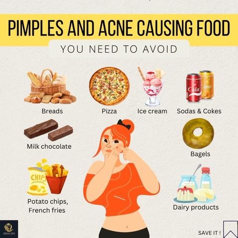 Things To Eat To Get Rid Of Acne, What Foods Cause Acne, Foods To Eat To Help With Acne, What Your Pimples Mean, Foods To Get Rid Of Acne, Foods To Eat To Get Rid Of Acne, What To Eat To Get Rid Of Acne, Acne Safe Foods, Foods That Cause Acne