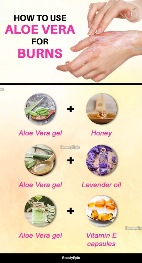 Burn Remedies, Skin Burn Remedy, Remedies For Burns Skin, Coconut Oil For Burns, How To Heal A Burn Quickly, Aloe For Sunburn, Home Remedies For Burns, Burn Remedy, Burn Care