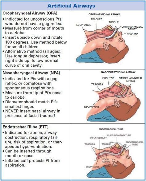 Respiratory Therapist Student, Respiratory Therapy Student, Emt Study, Nurse Anesthesia, Paramedic School, Med Surg Nursing, Dental Floss Picks, Nursing Mnemonics, Nursing School Survival