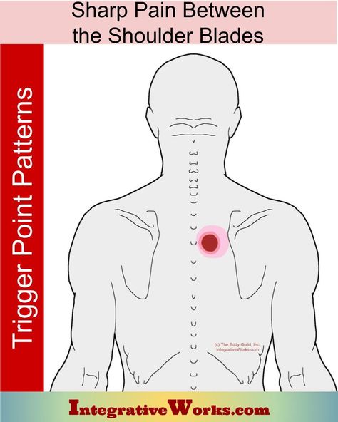 Sharp Pain Between the Shoulder Blades - Integrative Works Tattoo Between Shoulder Blades, Forward Head Posture Exercises, Back Spasm, Upper Back Muscles, Neck And Shoulder Muscles, Shoulder Blade Tattoo, Forward Head Posture, Lower Back Pain Exercises, Upper Back Pain