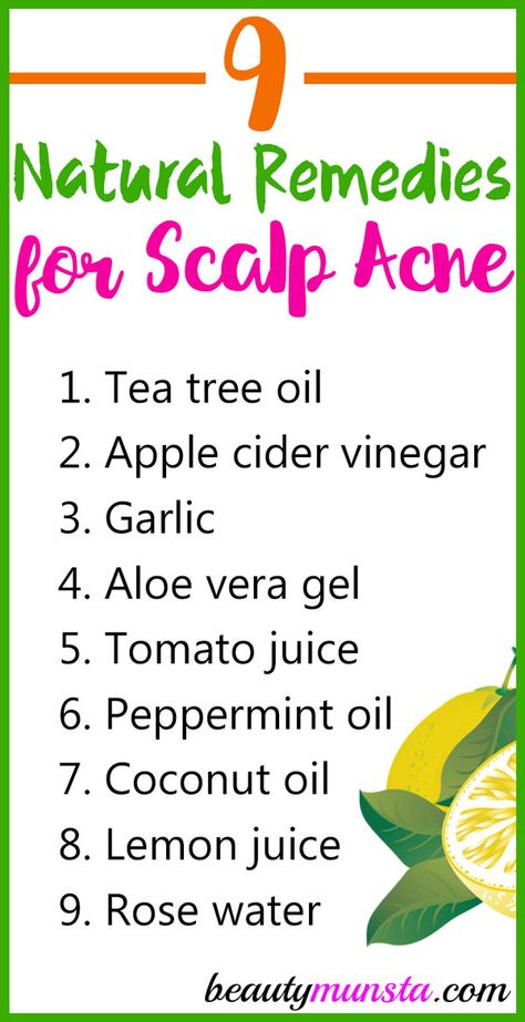 Scalp acne is horrible but the good thing is that it can be treated! Find out how to treat scalp acne naturally with natural remedies! Scalp acne can be something you never expected you could get but just end up with it one day. It’s just like facial acne but instead of a rash-like breakout, … Scalp Breakouts Remedies, Acne Breakout Remedies, Natural Remedies For Cystic Acne, Scalp Remedies, Fungal Acne Vs Bacterial Acne, Pimples On Scalp, Scalp Acne, Black Heads, Thick Hair Remedies