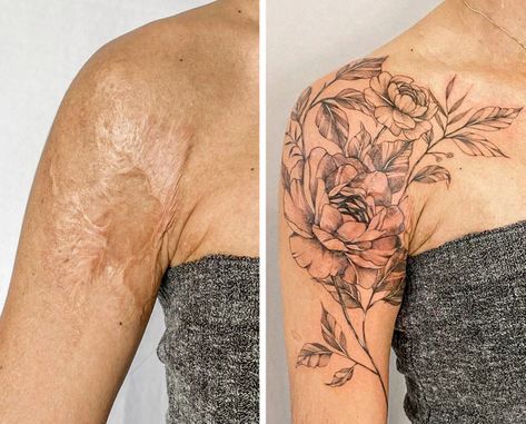 16 People Who Transformed Their Scars Into Pieces of Art / Bright Side Arm Lift Scar Tattoo Cover Up, Scars Tattoo, Best Cover Up Tattoos, Mastectomy Tattoo, Scar Cover Up, Upper Back Tattoos, Tattoos To Cover Scars, Scar Tattoo, Arm Lift