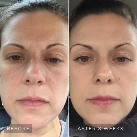 Redefine Regimen, Life Changing Skincare, Anniversary Dates, Rodan And Fields, Younger Looking Skin, Beauty Industry, Life Changing, Life Changes, Wrinkles