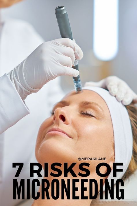 7 Things to Know Before Trying Microneedling Micro Needling Benefits, Microneedling Video, Rf Microneedling Before And After, Micro Needling Before And After, Microneedling Before And After, Products For Pores, At Home Microneedling, Microneedling Benefits, Benefits Of Microneedling