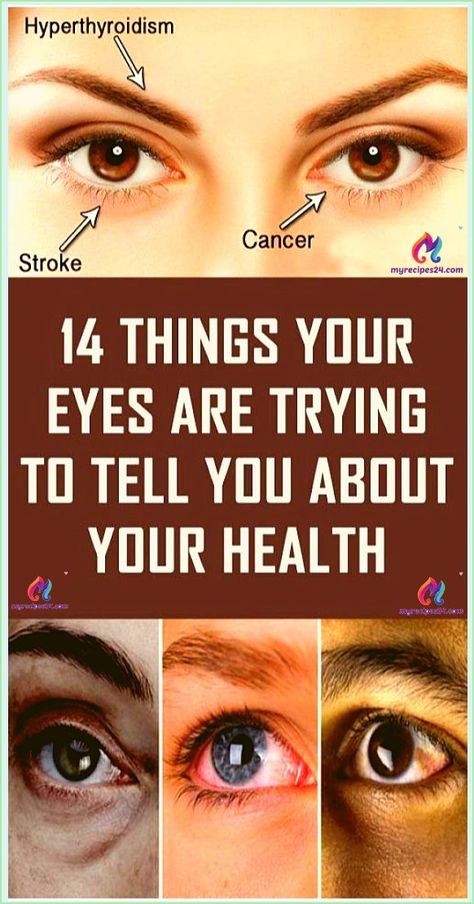 Here are a few things that your eyes say about your health. Some of the bad and common eyesight problems are due to larger health issues Women Health Care, Health Planner, Healthy Routine, Smokey Eyes, Eye Health, Health Facts, Health Remedies, Your Eyes, Natural Remedies