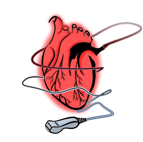 Design I did for the Echocardiography program and career. Echocardiography Aesthetic, Pediatric Echocardiography, Sonography Aesthetic, Echocardiography Ultrasound, Cardiac Ultrasound, Cardiac Sonography, Vascular Ultrasound, Heart Echo, Ultrasound Sonography