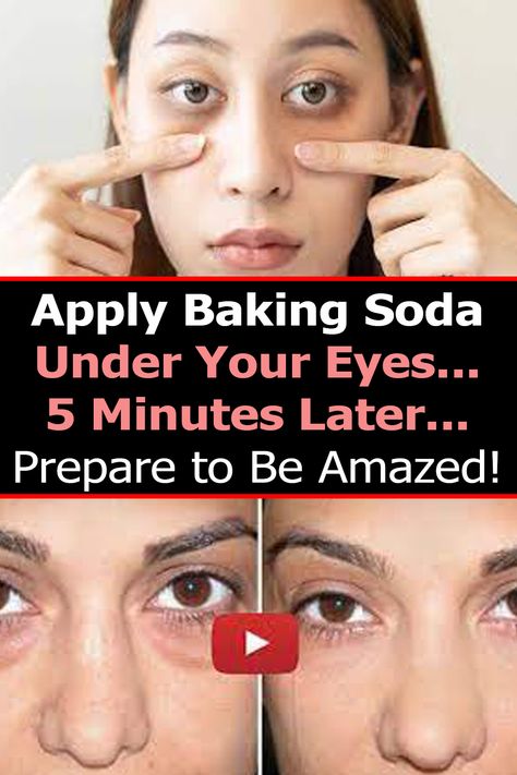 Baking Soda Under Eyes, Baking Soda Face, Hair Growth Women, Yoga Information, Grandparents Quotes, Healthy Life Hacks, Natural Beauty Remedies, Baking Soda Beauty Uses, Baking Soda Uses