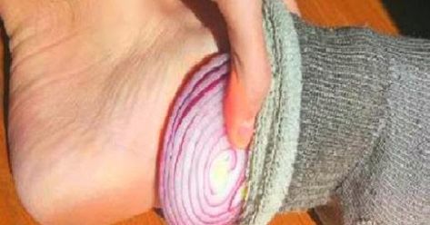 Onion In Sock, Onion In Your Sock, How To Stop Coughing, Salad Diet, Overnight Oat, Cough Remedies, Cold Remedies, Detox Your Body, Natural Healing