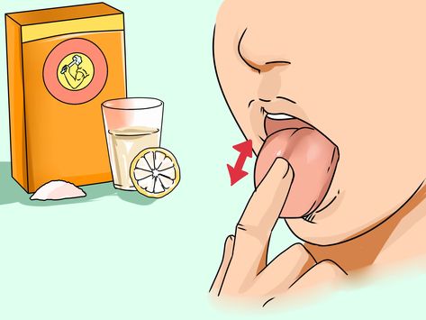 White Tongue Causes, Bumps On Tongue, Burnt Tongue, Burning Tongue, Healthy Tongue, Tongue Sores, White Tongue, Tongue Health, Tongue Cleaner