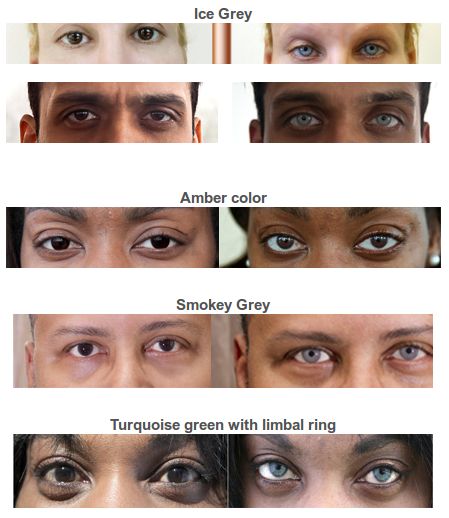 Bright Ocular, Change Your Eye color permanently Eye Color Change Surgery, Change Your Eye Color, Heart Diet, Reduce Body Fat, Healthy Advice, Silver Eye, Amber Color, Fitness Planner, Eye Color