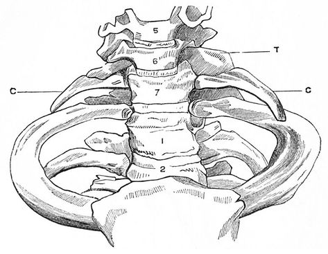 Thoracic Outlet, Physiotherapy Exercises, Subclavian Artery, First Rib, Vascular Surgery, Muscle Atrophy, Cervical Vertebrae, Scar Tissue, Anatomy And Physiology