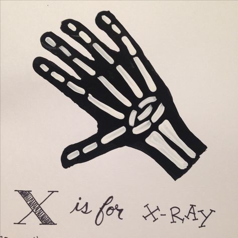 X Ray Handprint Craft, X Handprint Craft, Letter X Craft For Preschoolers, Alphabet Footprints, Fish Handprint Craft, Handprint Alphabet, X Ray Fish, Letter X Crafts, Fish Handprint