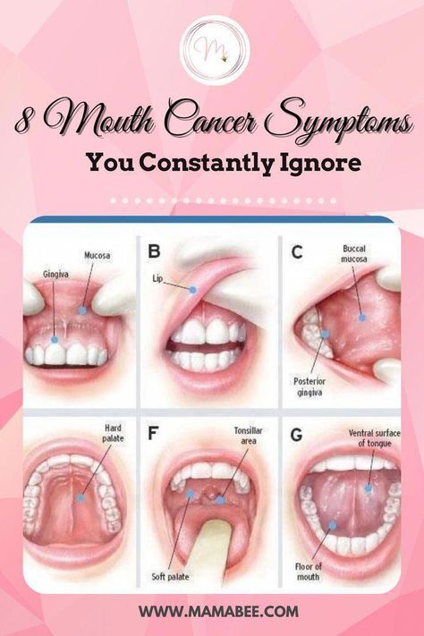 Tonsil Stone Removal, Tonsil Stone, Soft Palate, Nails Health, Tongue Health, Stronger Teeth, Oral Care Routine, Health Care Tips, Oral Health Care