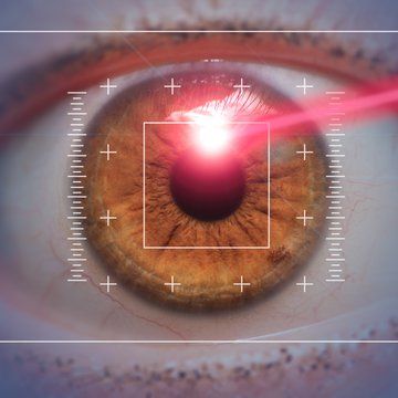 “…going to be very rare cases of individuals who may have difficulty that can be attributed to the surgery, but I think that’s true of any kind of procedure." To Improve Eyesight, Laser Vision Correction, Lasik Eye Surgery, Laser Vision, Laser Eye Surgery, Lasik Surgery, Safety Procedures, Laser Surgery, Laser Eye