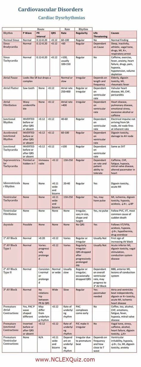 Cardiac Dysrhythmias, Cardiac Rehab, Ekg Interpretation, Paramedic School, Nurse Study, Nursing Cheat, Nursing Information, Cardiovascular Disorders, Study Stuff