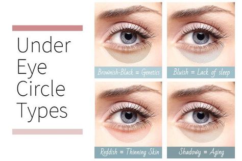 Find out the real causes of your under eye circles Under Eye Circles, Dark Under Eye, Eye Circles, Undereye Circles, Puffy Eyes, Eye Bags, Health And Beauty Tips, Looks Style, Cool Eyes