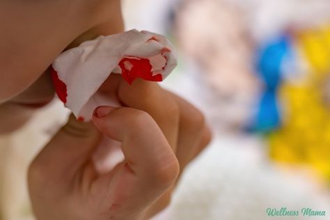 What Causes Nosebleeds in Adults and Kids ( Natural Remedies) Quadrants Of The Abdomen, Parts Of The Nose, Nose Picking, Nose Bleeds, Wellness Mama, Nasal Passages, Nose Shapes, Natural Cold Remedies, Sinus Infection