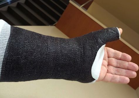 Arm Cast, Fingerless Gloves, Arm Warmers, Gloves, It Cast, Black