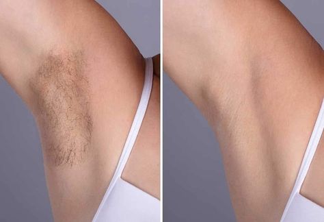 Your underarms will look and feel so much better when you get them waxed! 509-961-6555 #underarmwax #soymarvelous #nomorehair #waxingstudio #hairless #hairfree #waxspecialist #yakima #bebare #bodywaxspecialist #waxstudio #bodywax #femalewaxing #malewaxing #yakimawaxing #fromheadtotoe #barebliss #beauty #bodywaxing #waxingspecialist #waxingyakima #fullbodywax #hairremoval #fullbodywaxing #underarmwaxing Best Hair Removal Products, Hair Eraser, Armpit Fat, Underarm Hair Removal, Hair Removal Methods, Effortless Hairstyles, Grooming Routine, Unwanted Hair Removal, Unwanted Hair