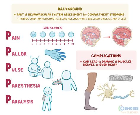 Osteoporosis Nursing, Emergency Doctor, Nerve Fiber, Nurse Inspiration, Peripheral Nerve, Med Surg, Emergency Nursing, Medical Studies, Nursing Tips