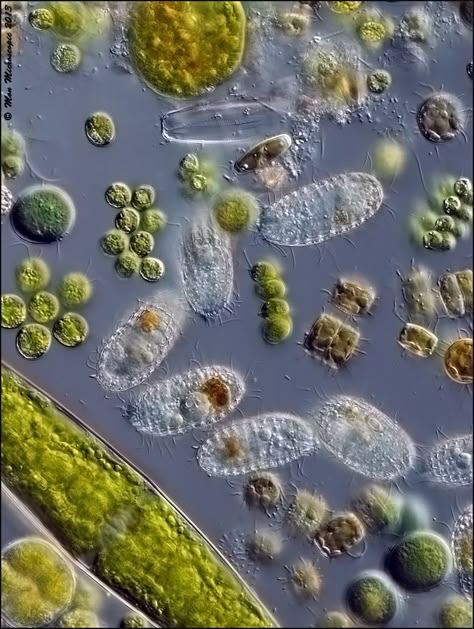 All sorts of little things in the water Plankton Microscope, Microorganisms Microbiology, Bacteria Microscope, Rotten Vegetables, Water Inspiration, Foto Macro, Microscopic Organisms, Microscopic Photography, Micro Photography