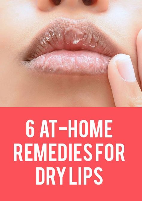 "My lips feel rough and dry and I’m so over it. I’ve been trying lip scrubs and all different kinds of lip balm, but nothing seems to be truly solving my problem. In case you’re in the same boat as me, here are six at-home remedies to soothe your dry lips." Remedies For Dry Lips, Lips Remedies, Dry Lips Remedy, Cracked Lips, Zero Calories, Skin Remedies, Chapped Lips, Dry Lips, Lip Scrub