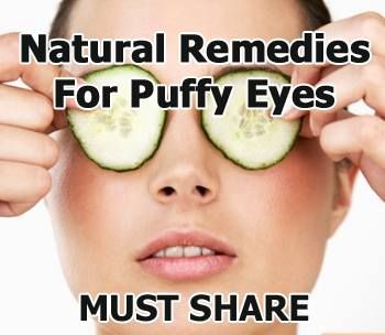 Kiss away Puffy Eyes! - Sleepless and restless nights, fluid retention, stress, production of tears in extreme it can put a strain on the eyes; Tiredness is another regular cause for puffy eyes. Well don’t worry, there are various remedies you can do to reduce puffiness…Eyecare can be quite a thing to figure out but once you got it, you have got it! There are several inexpensive home remedies for puffy eyes... Pickles Cucumbers, Puffy Eyes Remedy, Baggy Eyes, Cucumber On Eyes, Cucumber Face, Face Spray, Eye Creams, Under Eye Bags, Peeling Skin