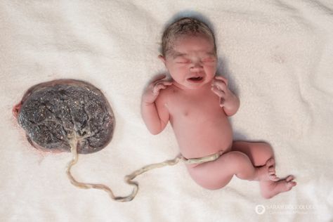 Baby attached to placenta, Denver, Colorado Lotus Birth, Birth Pictures, Crunchy Moms, Umbilical Cord, Parenting Plan, Pregnancy Essentials, Birth Photographer, Natural Pregnancy, Birth Photography