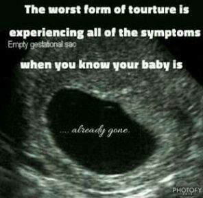 I think the worst form of torture was the three days I had to walk around with my baby inside me, knowing they were gone, waiting for surgery... 💔 Blighted Ovum, Pregnancy Loss Awareness, Infant Loss Awareness, Ectopic Pregnancy, Pregnancy And Infant Loss, Early Pregnancy, Child Loss, Pregnancy Loss, Infant Loss