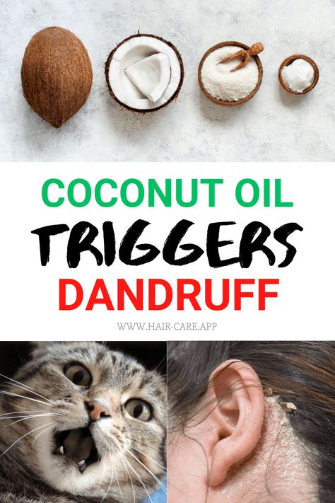 Do you still believe that coconut oil is the most powerful natural remedy for your hair and scalp? You might be wrong! Coconut oil is not for all hair types. Moreover, it can trigger dandruff... Click on the pin to learn more #hair #haircare #hairproducts Coconut Oil For Dandruff, Whipped Coconut Oil, Grow Long Healthy Hair, Liquid Coconut Oil, Apply Coconut Oil, Porous Hair, Homemade Hair Mask, Diy Coconut Oil, Coconut Oil Hair Mask