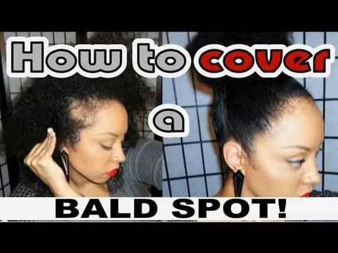 Yup...I have a bald spot. I was born with it; a sort of "birth-mark" if you will. As a kid and teenager I used to HATE IT, but it doesn't bother me the SLIGHTEST anymore, but I do cover it up on occasion. This video shows you what I do, and how I do it :)    INSTAGRAM- MlleCafeAuLait    PRODUCTS / Tools used  Water  Karen's Body Beautiful Leave-In Con... Hairstyles To Hide Bald Spots, Hairstyles To Cover Bald Spots, Thinning Edges, Curly Nikki, Traction Alopecia, Hair Secrets, How To Grow Natural Hair, Hair Issues, Bald Spot