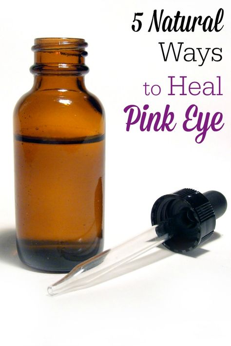 Don't spent money on doctor's visits or prescription antibiotic drops! Check out these natural ways to heal pink eye! These really work to heal pink eye! Pink Eye Remedies, Treating Pink Eye, Natural Pink Eye Remedy, Pinkeye Remedies, Crunchy Mama, Ways To Heal, Alternative Living, Raising Daughters, Healthy Children