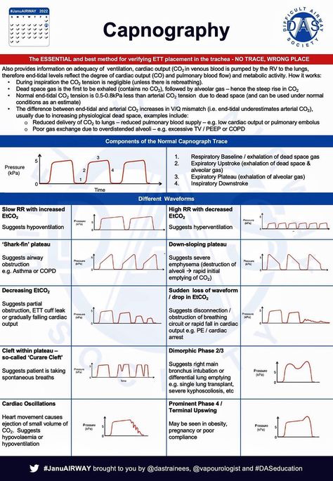 Paul Wischmeyer MD ⎪ #NutritionMatters 💪 on Twitter: "💡Excellent Capnography Overview #MedEd #MedTwitter #FOAMed H/T @BrownJHM https://t.co/S9RSKRDZVT" / Twitter Airway Management, Medical Student Study, Respiratory Therapy, Dead Space, Student Studying, Medical Students, Paramedic, Blood Flow, Medical