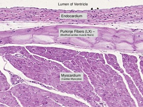 Purkinje fibres - Note: They are modified cardiac "muscle" 【 Note : Whole conduction system of heart is made of " modified cardiac muscles " 】 Heart Histology, Cardiac Muscle, Heart Circulation, Histology Slides, Lab Work, Heart Anatomy, Medical Laboratory Science, Study Related, Med Surg