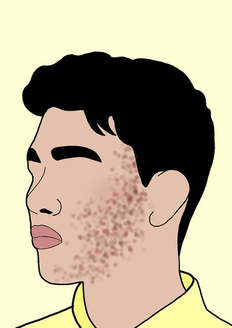 Acne Illustration Art, Normalise Acne, Skin Care Illustration, Care Illustration, Movement Art, Animated Man, Skincare Quotes, Art Commissions, Face Acne