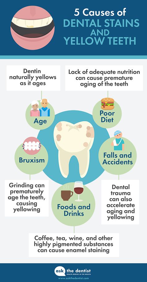 Dental Posts, Dental Posters, Kedokteran Gigi, Dental Fun, Dental Facts, Yellow Teeth, Dental Cosmetics, Gum Care, Receding Gums