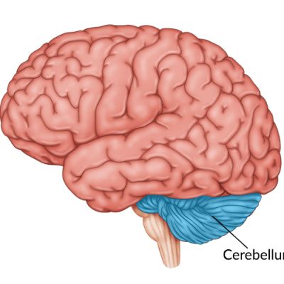 Foods That Help Stroke Recovery: 15 Evidence-Backed Options Types Of Strokes, Cerebral Cortex, Vision Therapy, Cognitive Therapy, Physical Therapy Exercises, Brain Stem, Visual Memory, Improve Cognitive Function, Vision Problems