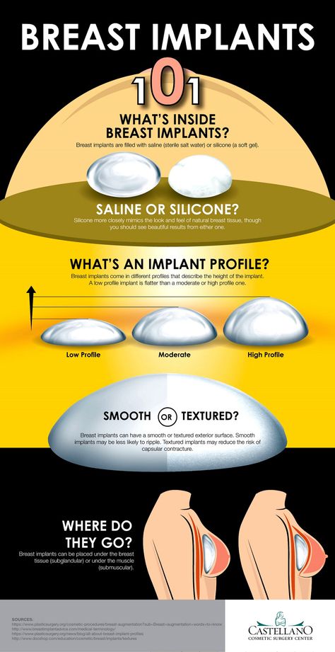 Breast Implants 101: What’s Inside Breast Implants? A To C Cup Implants, Saline Implants, Increase Breast Size, Breast Implant Illness, Instant Potatoes, Mammary Gland, After Surgery, Ins And Outs, Fitness Advice