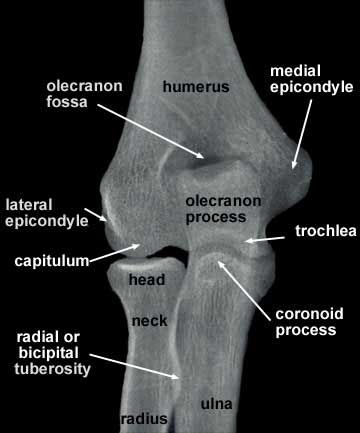 Elbow Xray Anatomy, Elbow Xray, Medial Epicondyle, Elbow Anatomy, Anatomy Lab, Radiology Schools, Radiologic Technology, Radiologic Technologist, Radiology Student