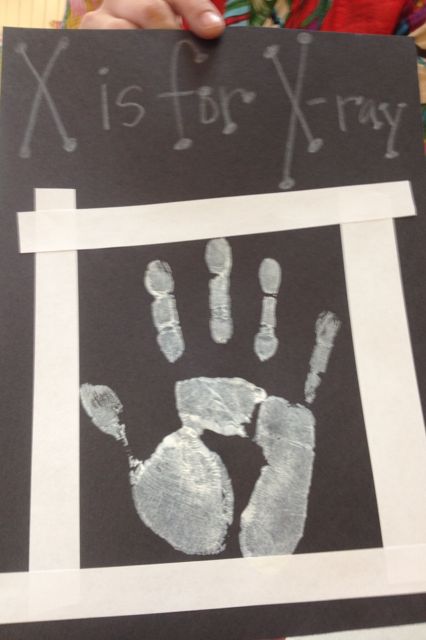 X is for X-ray - handprint X Is For Handprint Craft, Preschool X Ray Craft, Preschool X Ray Activities, The Letter X Preschool Crafts, X Ray Preschool Craft, X Crafts Preschool, Letter X Handprint Craft, Preschool X Crafts, Letter X Arts And Crafts For Preschool