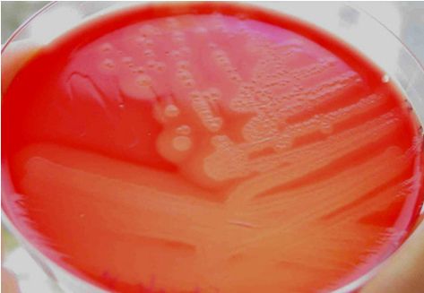 Clostridium perfringens Clostridium Perfringens, School Study, Microbiology, Study Guide, Lab, Fruit