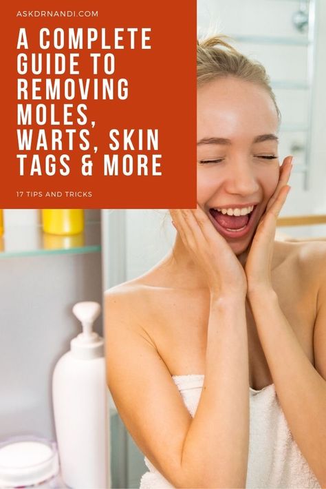 A Complete Guide to Removing Moles, Warts, Skin Tags Removing Moles Naturally, How To Remove Moles Naturally, Skin Tags What Causes, Skin Tags On Face, Remove Skin Tags Naturally, Skin Moles, Mole Removal, Skin Tags, Skin Natural Remedies