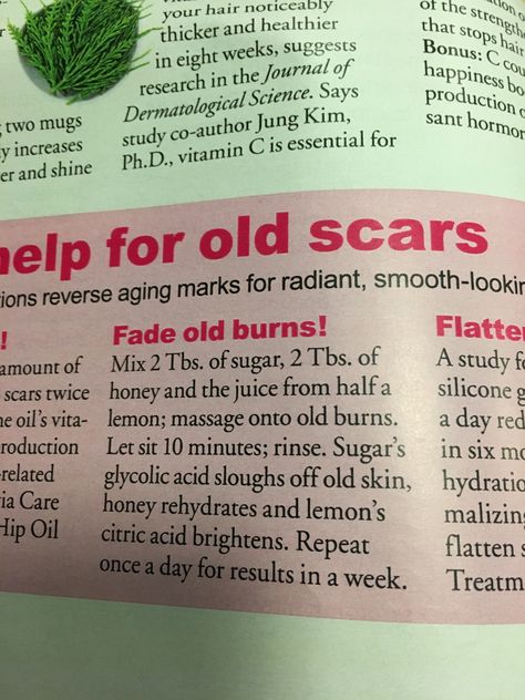 Burn Scar Remedies, How To Fade Scars, Scar Remedies, Skin Improvement, How To Fade, Growing Healthy Hair, Pimples Remedies, Homemade Products, Beauty Tips For Glowing Skin