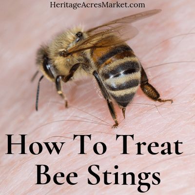 Bee Sting Swelling, Treating Bee Stings, Remedies For Bee Stings, Sting Relief, Wasp Stings, Beekeeping For Beginners, Backyard Beekeeping, Carpenter Bee, Bee Sting