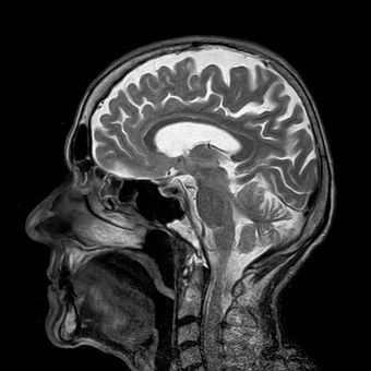 20+ Free Mri & Medical Images - Pixabay White Matter In Brain, Xray Art, Brain Images, White Matter, Magnetic Resonance Imaging, Medical Imaging, Magnetic Resonance, Human Head, Black And White Canvas