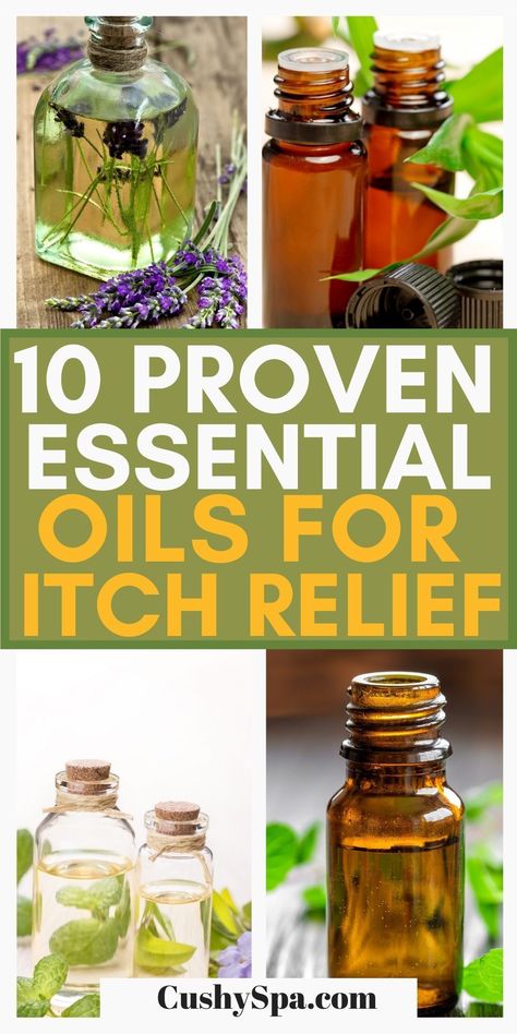 Natural Remedies For Itching Skin, Essential Oil Itch Relief, Essential Oils For Itching Skin, Essential Oil For Itchy Skin Itch Relief, Essential Oils For Itchy Skin, Itching Remedies Skin, How To Stop Itching Skin, Oils For Itchy Skin, Essential Oils For Rash