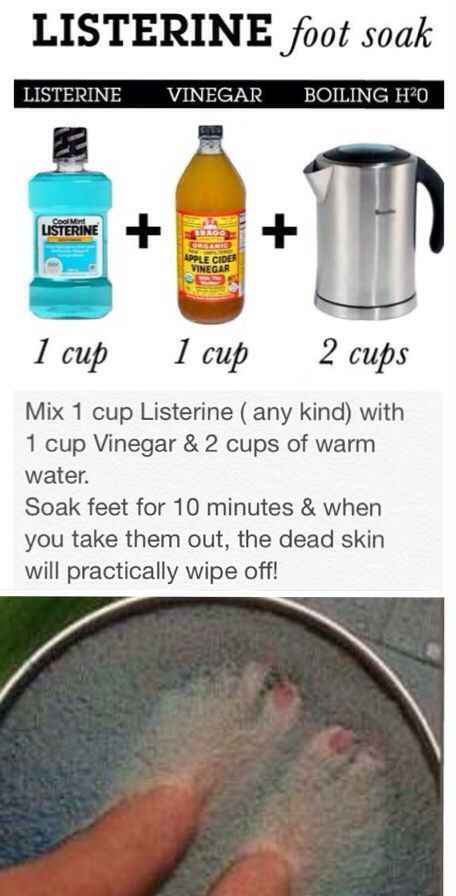 Vinegar Foot Soak, Listerine Foot Soak, Foot Soak Recipe, Foot Soak, Juice Recipes, Beauty Remedies, Skin Care Remedies, Natural Health Remedies, Diy Skin