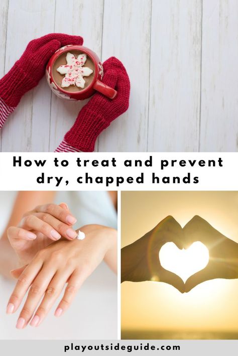 how to treat and prevent dry chapped hands Chapped Hands Remedy, Unscented Lotion, Chapped Hands, Play Outside, Skin Detox, Dry Skin Care, Best Moisturizer, Dry Hands, Moisturizer Cream